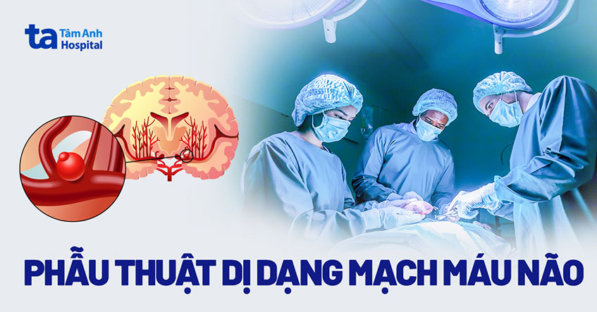 Phẫu thuật dị dạng mạch máu não