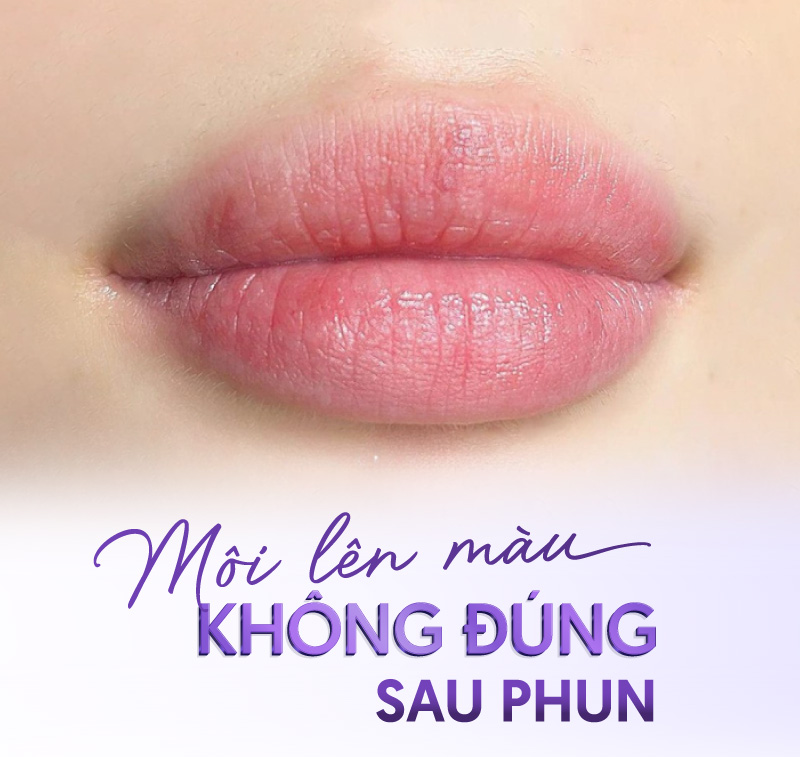 bảng giá phun môi