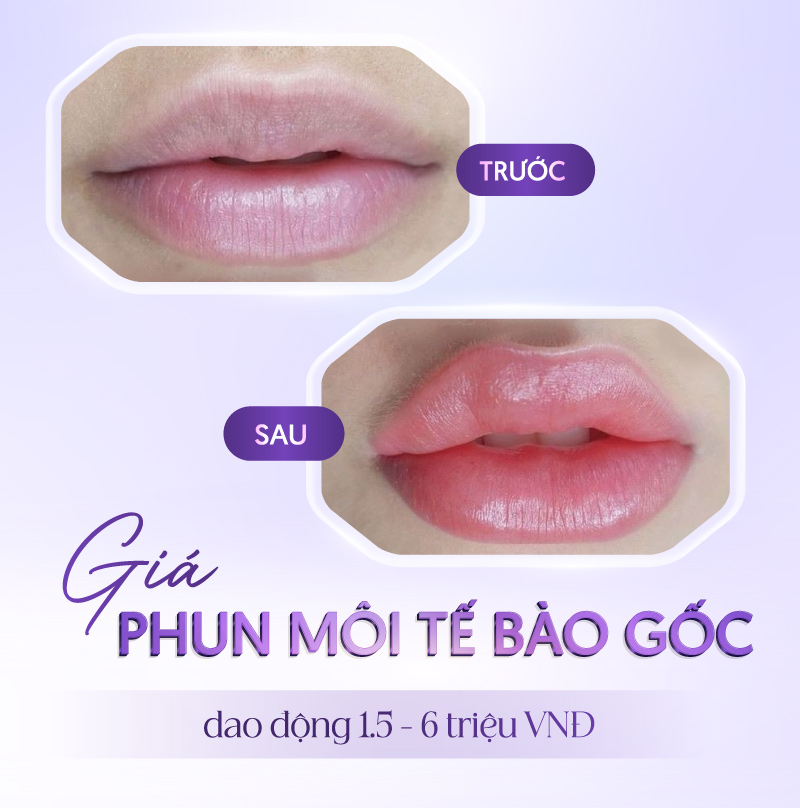 phun môi collagen bao nhiêu tiền