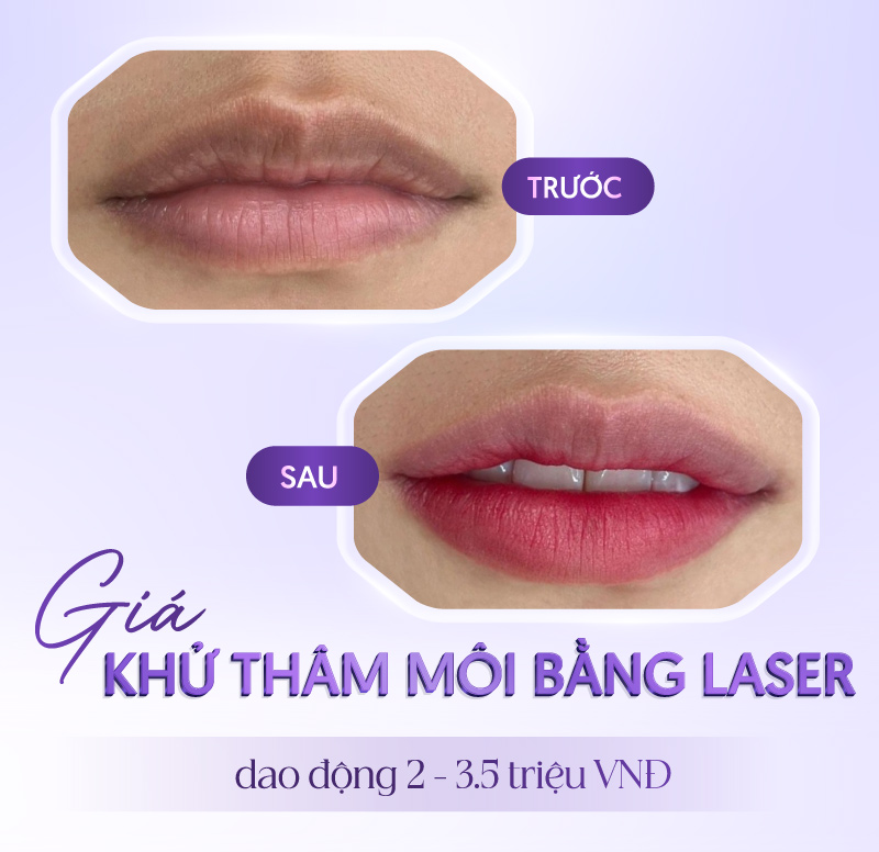 phun môi bao nhiêu tiền