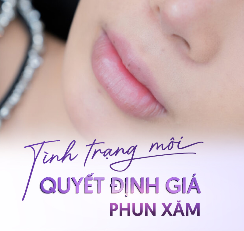 phun môi linh anh