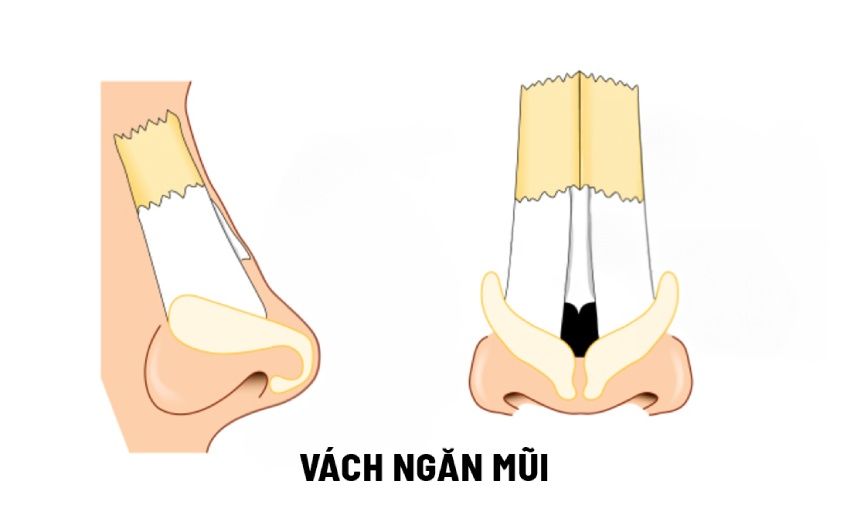 cấu trúc mũi