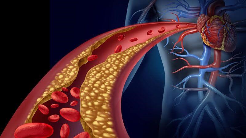 Lượng cholesterol trong cơ thể có thể giảm nhờ các thành phần axit béo được chiết xuất từ mỡ trăn