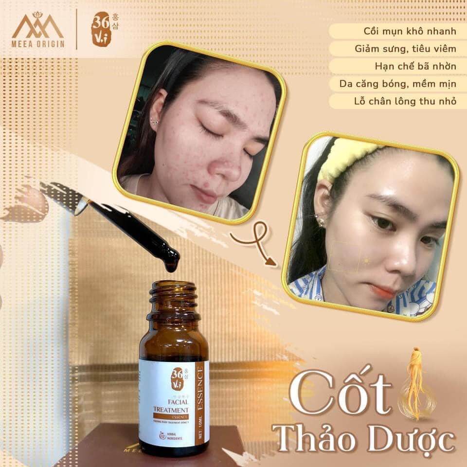 Cốt huyết thanh thảo dược 36 vị full 10ml