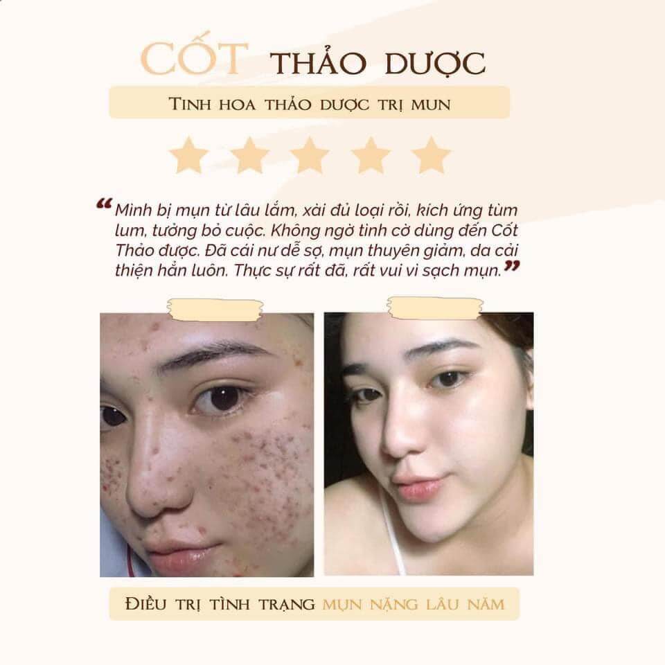 Cốt huyết thanh thảo dược 36 vị full 10ml