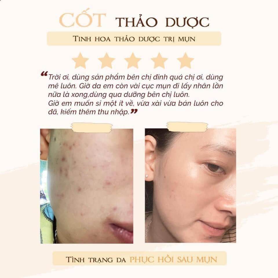 Cốt huyết thanh thảo dược 36 vị full 10ml