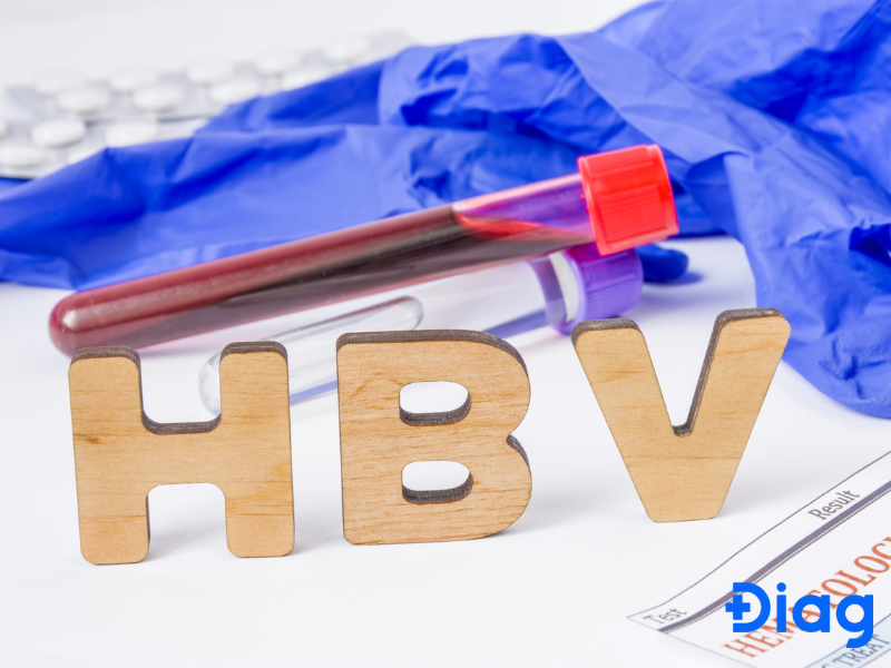 Xét nghiệm HBV hỗ trợ chẩn đoán bệnh viêm gan B.