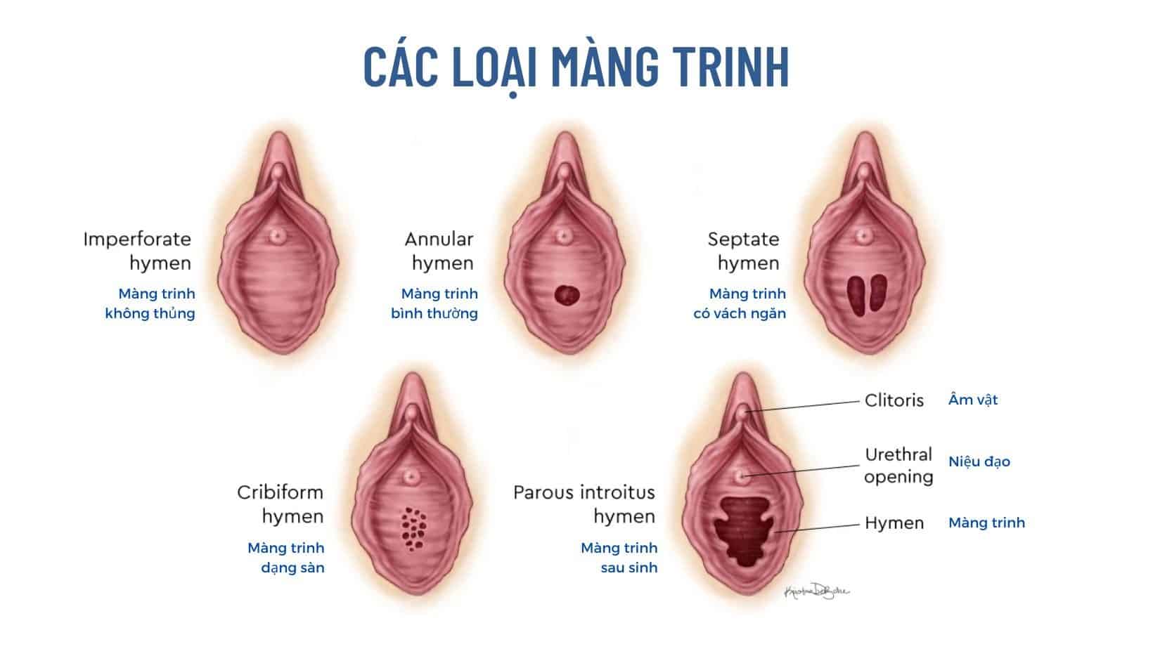 Cách chăm sóc sức khỏe các cơ quan sinh dục nữ