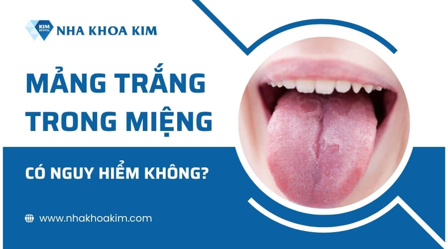 Mảng trắng trong miệng có nguy hiểm không?