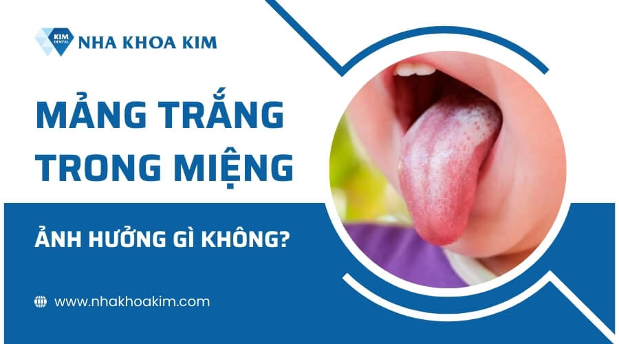 Mảng trắng trong miệng có ảnh hưởng gì không?