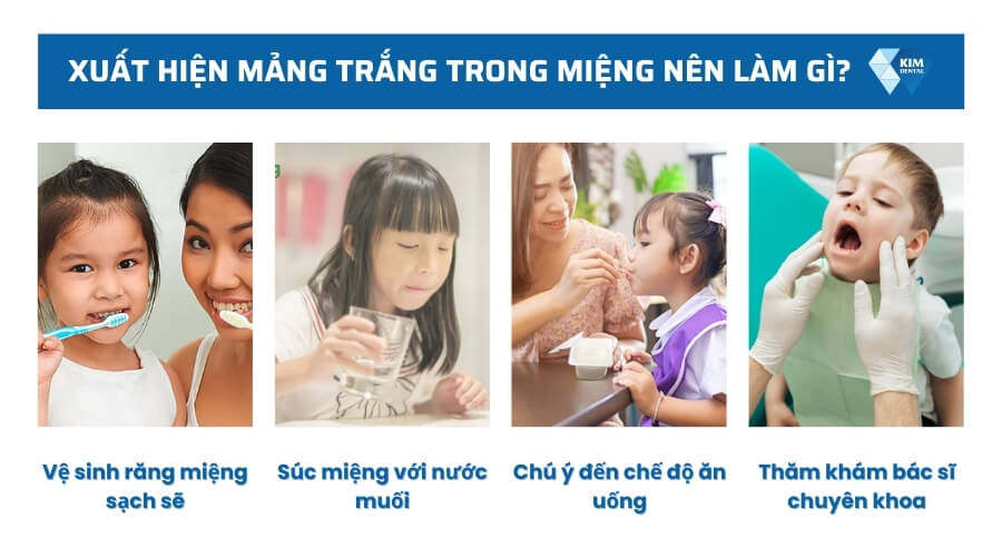 Xuất hiện mảng trắng trong miệng thì nên làm gì?