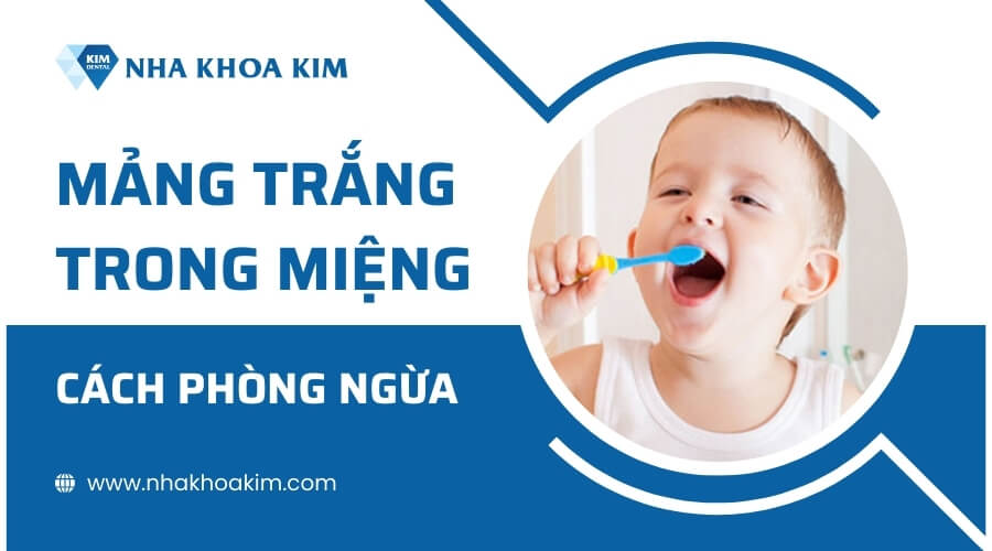 Cách phòng ngừa mảng trắng trong miệng