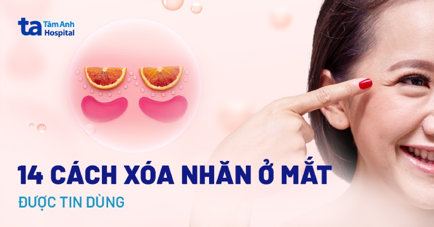 xóa nếp nhăn vùng mắt