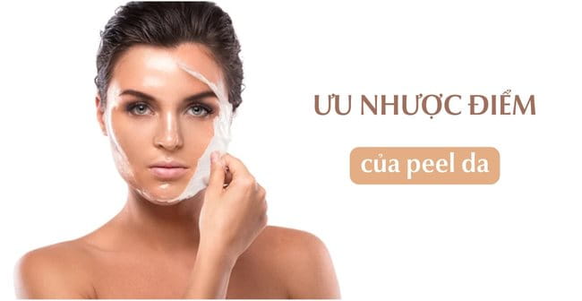 Ưu và nhược điểm của phương pháp peel da