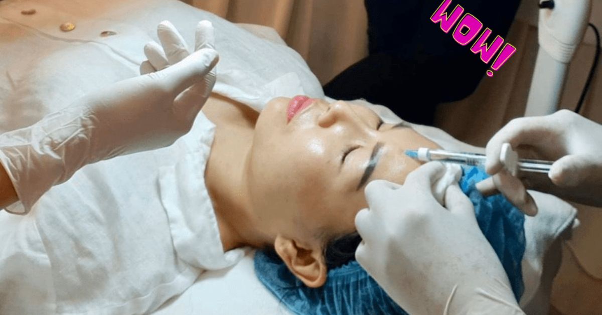 tiêm filler tại phòng khám da liễu thẩm mỹ Thái Hà