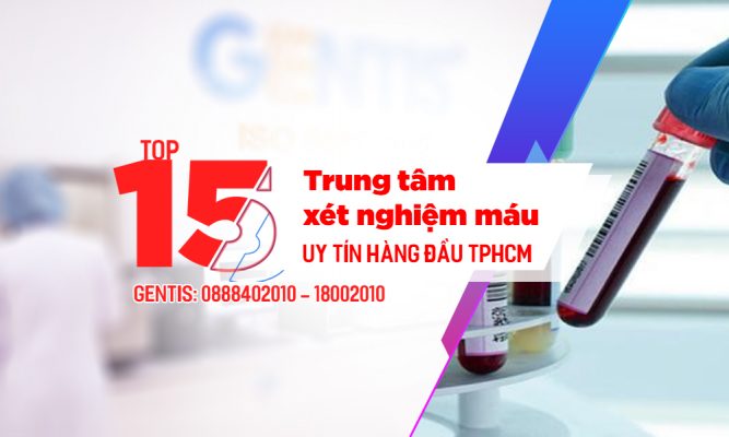 Tổng Hợp 15 địa Chỉ Xét Nghiệm Máu Uy Tín Tphcm