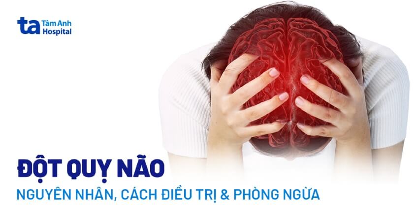 đột quỵ não