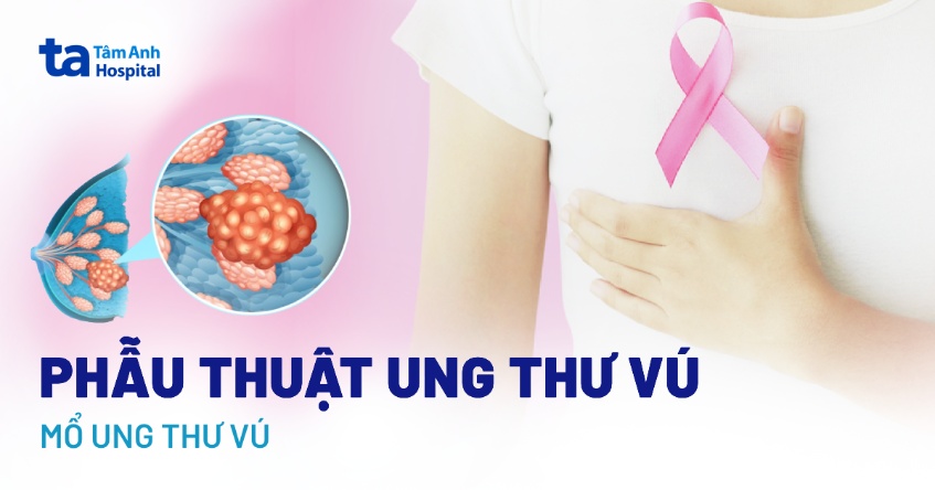 phẫu thuật ung thư vú