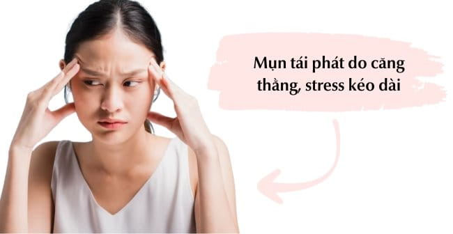 Mụn tái phát do stress