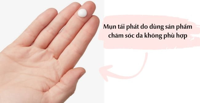 Sử dụng sản phâm chăm sóc da không phù hợp khiến mụn quay lại