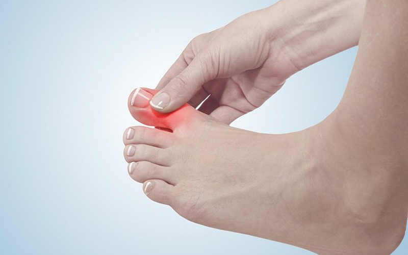 Điểm danh những loại thuốc trị gout của Pháp tốt nhất hiện nay 1