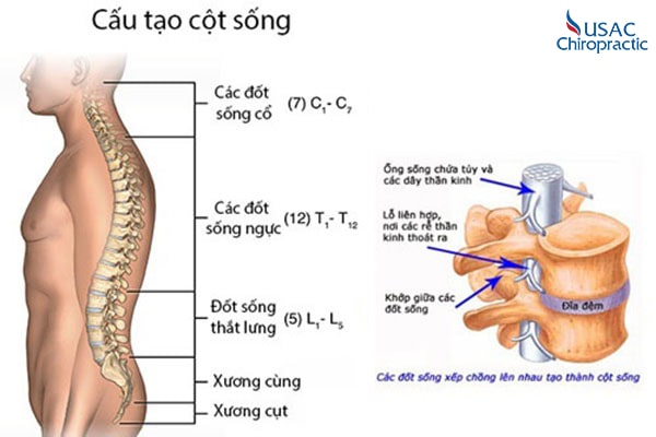 Xương cột sống bị lồi