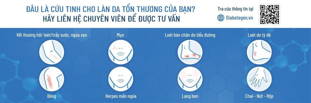 Những tổn thương da thường gặp có thể được cải thiện tình trạng tại nhà.