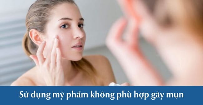 Da mặt bùng phát mụn có thể do sử dụng mỹ phẩm không phù hợp