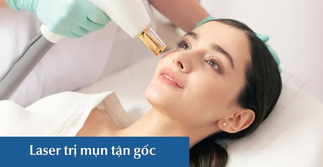 Liệu pháp công nghệ cao điều trị mụn mức độ nặng