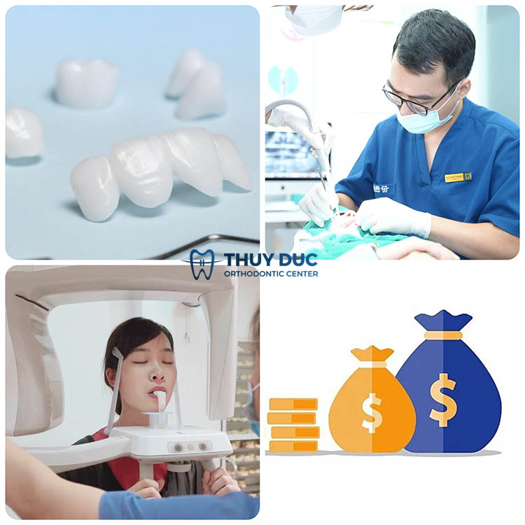 Nha khoa Thúy Đức- Địa chỉ bọc răng sứ uy tín tại Hà Nội 1