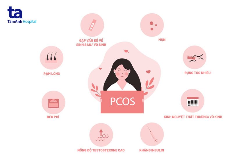 bệnh lý pcos