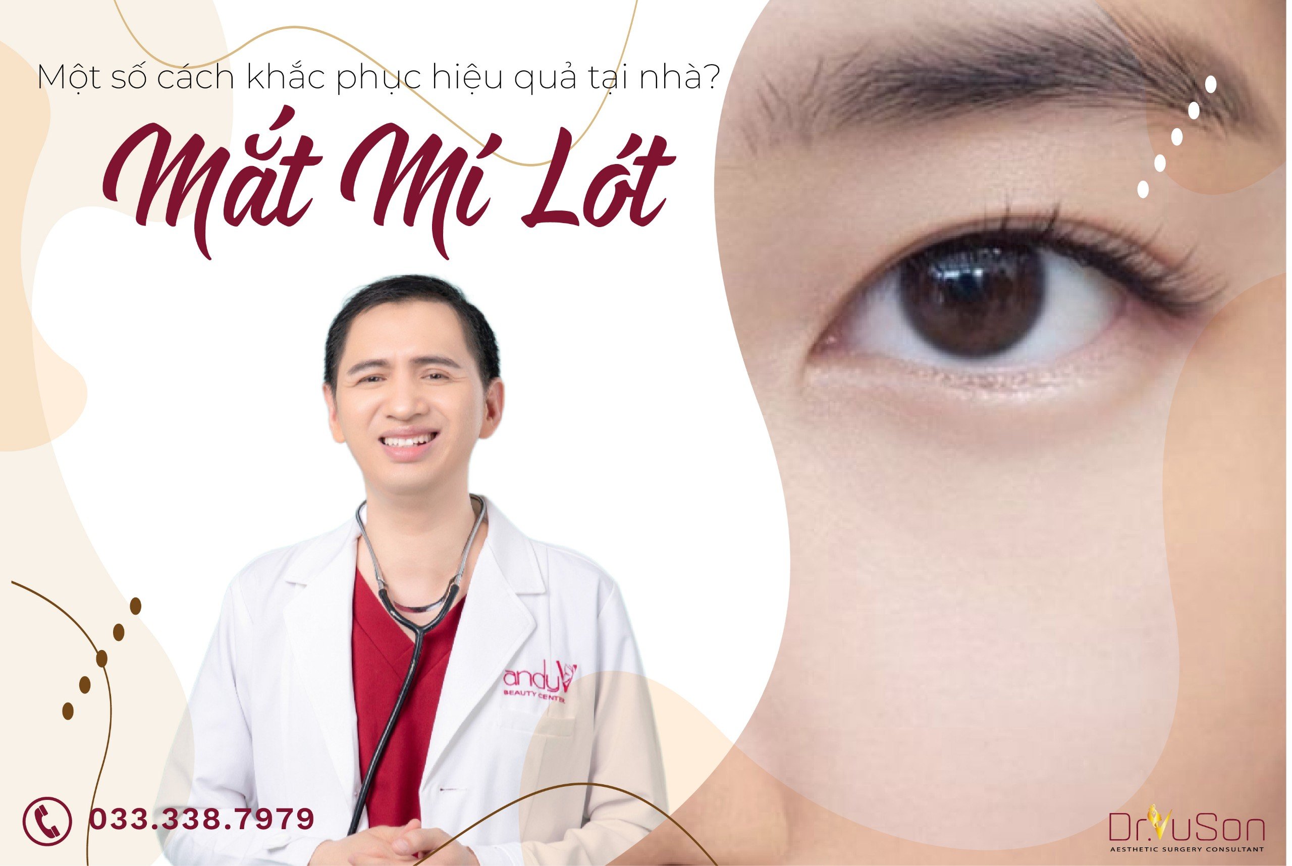 Một số cách khắc phục mắt mí lót hiệu quả tại nhà?