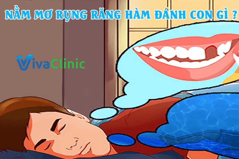 giấc mơ rụng răng hàm