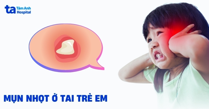 Mụn nhọt ở tai trẻ em