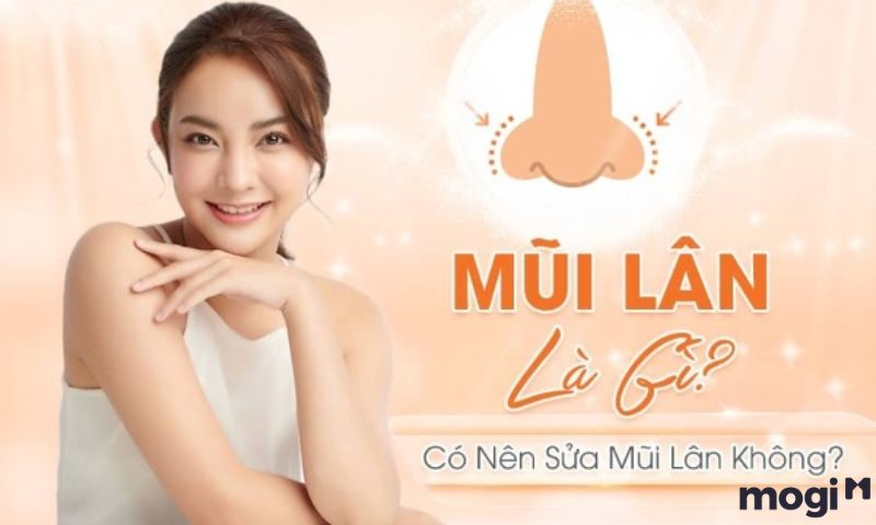 Nên cân nhắc kỹ khi sửa mũi lân