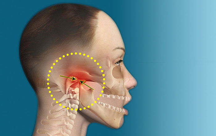 Ăn nhai 1 bên gây rối loạn khớp thái dương hàm