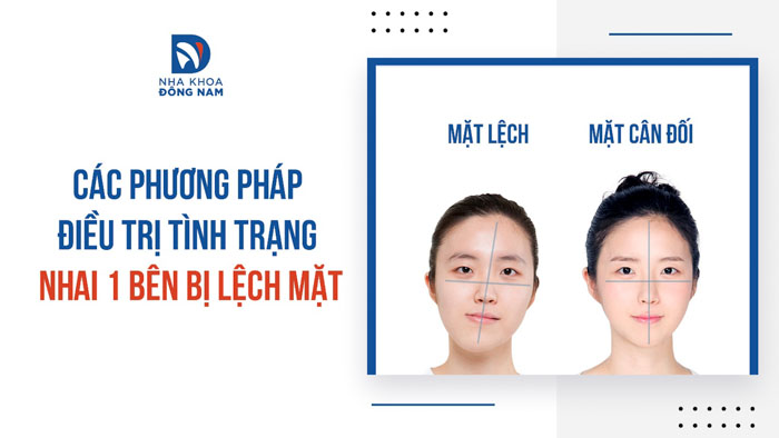 Các phương pháp điều trị tình trạng nhai 1 bên bị lệch mặt