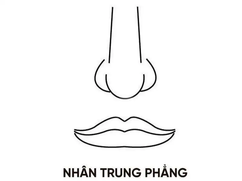 Nhân trung bằng phẳng