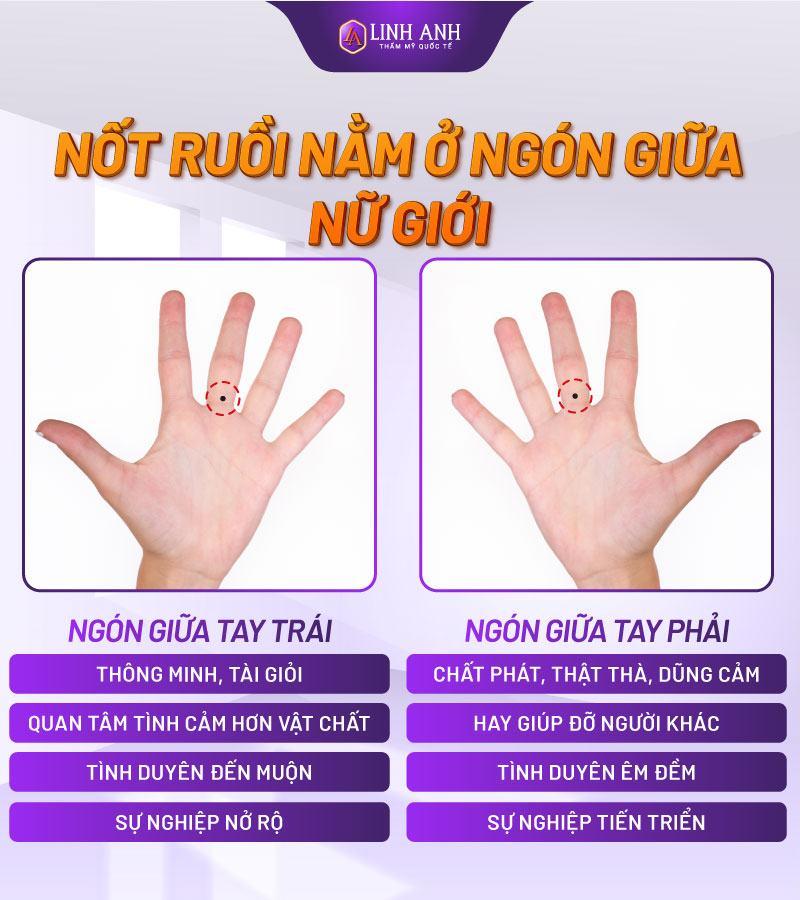 Nốt ruồi ở ngón tay giữa