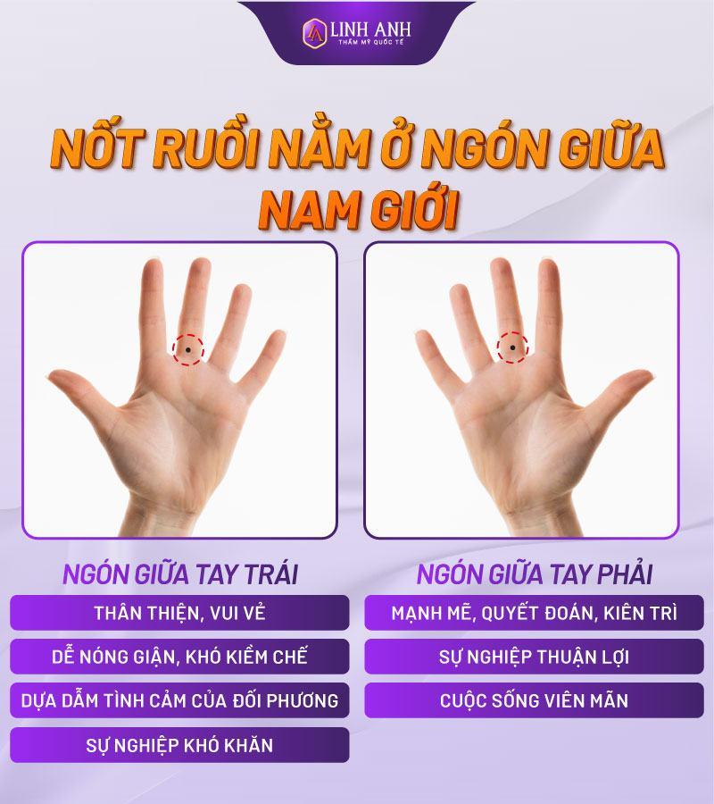 Nốt ruồi ở ngón áp út