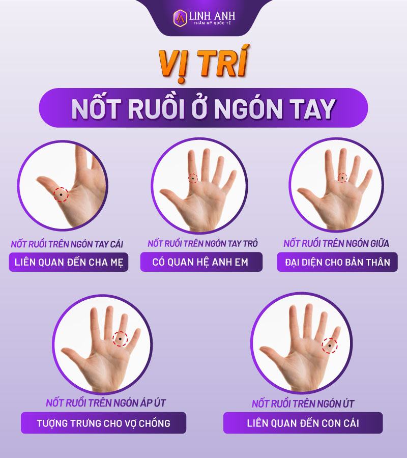 Vị trí nốt ruồi ở ngón tay