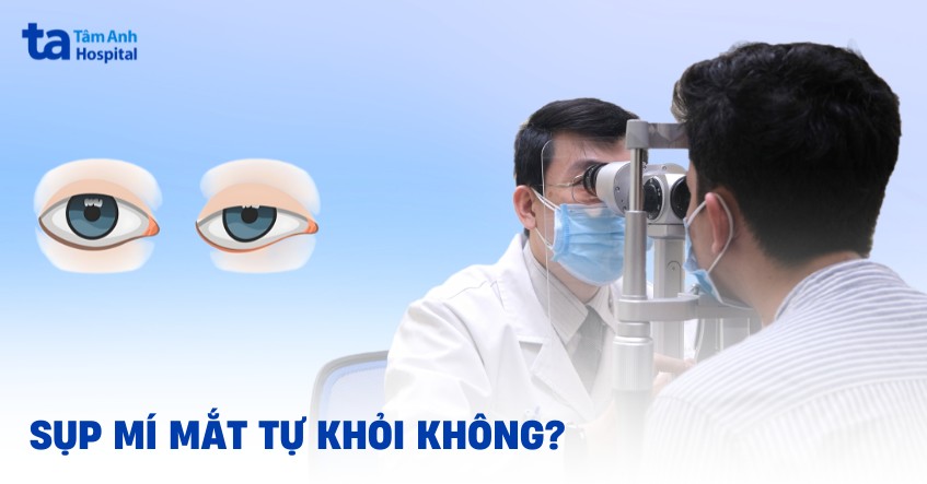 sụp mí mắt có tự khỏi không