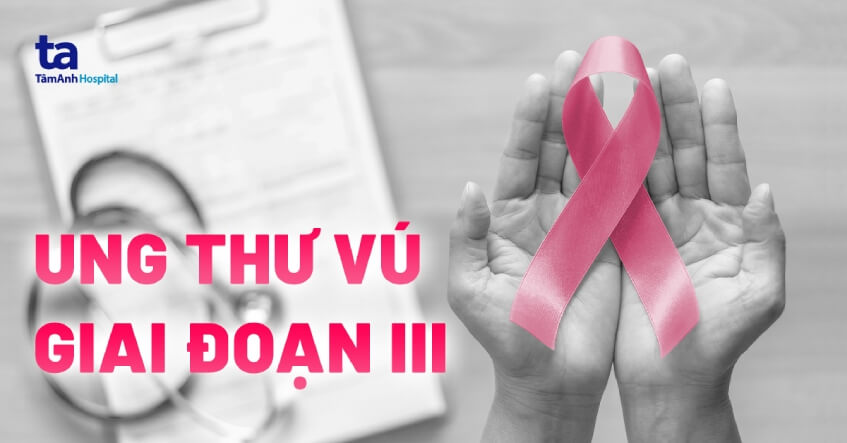 ung thư vú giai đoạn 3