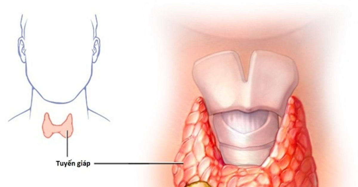 Máy móc xạ trị tại bệnh viện