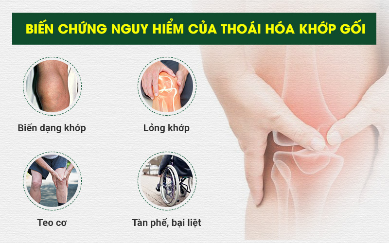 Biến chứng bệnh cơ xương khớp để lại những hậu quả nặng nè đến với người bệnh.