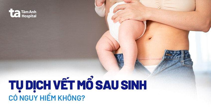 Tụ dịch vết mổ sau sinh: Nguyên nhân, dấu hiệu, chẩn đoán và phòng ngừa