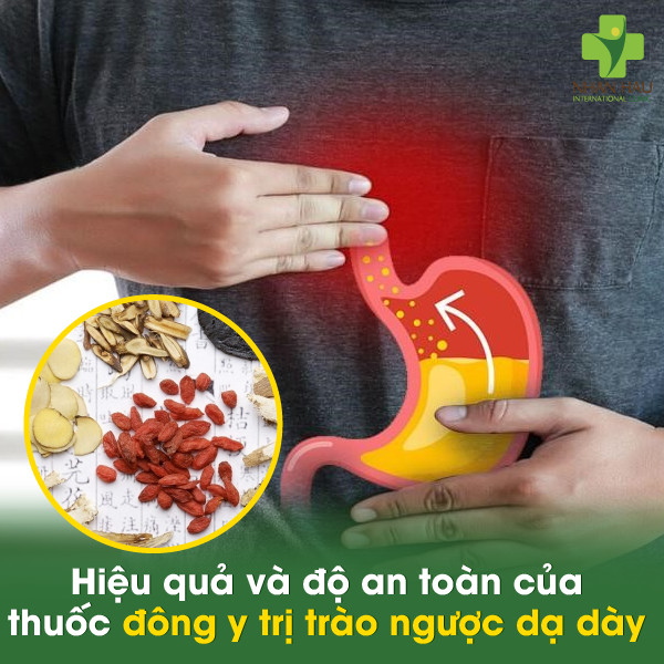 Hiệu quả và độ an toàn của thuốc đông y trị trào ngược dạ dày