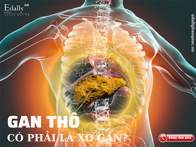 Gan thô có phải là xơ gan không? Nên làm gì khi có chẩn đoán gan thô?