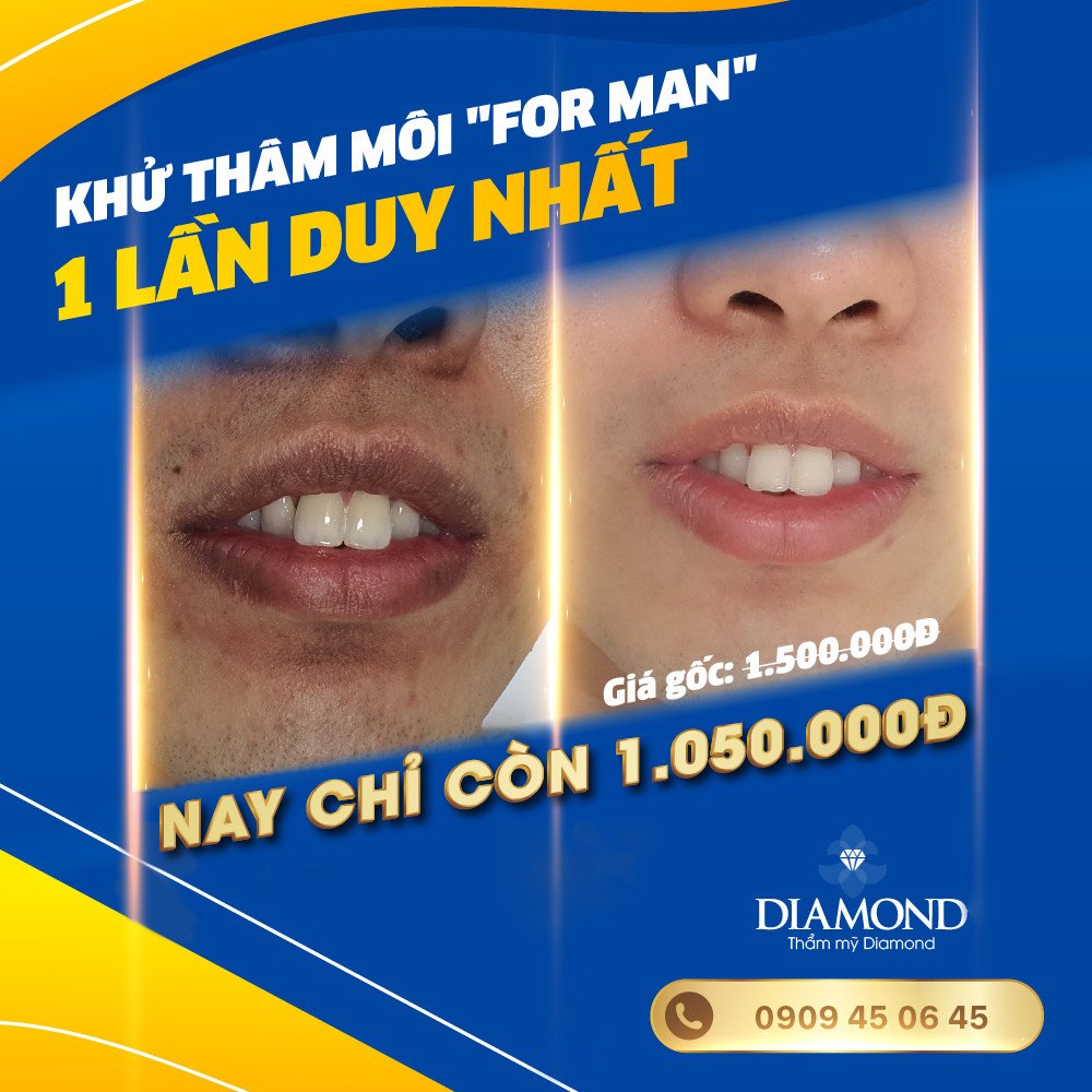 Khử thâm môi giảm 30%