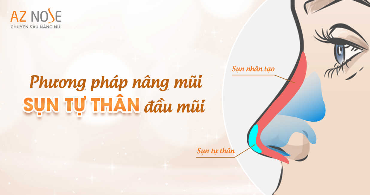 Phuong phap nang mui sun tu than dau mui